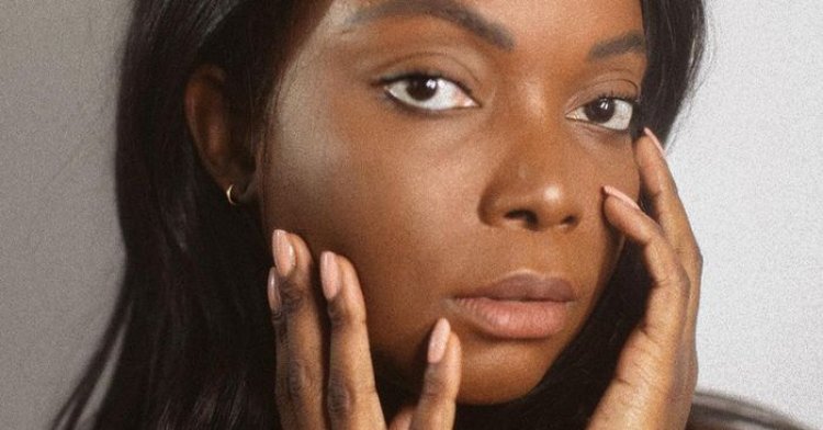 3 Common Mistakes That Cause Hyperpigmentation and the Creams to Fix It